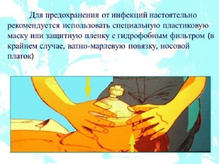 реанимация