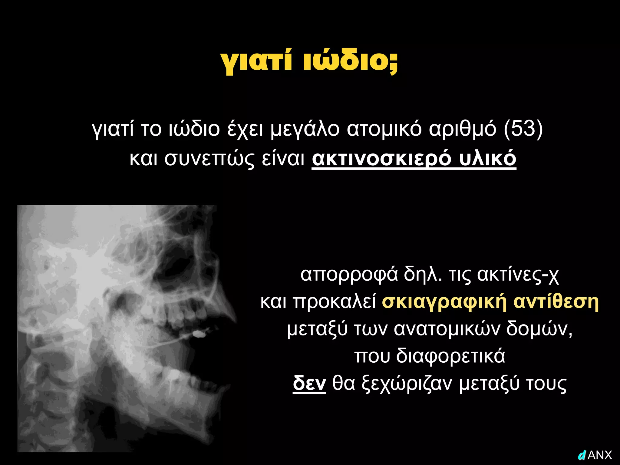 γιατί ιώδιο;

γιατί το ιώδιο έχει μεγάλο ατομικό αριθμό (53)
    και συνεπώς είναι ακτινοσκιερό υλικό




                      απορροφά δηλ. τις ακτίνες-χ
                 και προκαλεί σκιαγραφική αντίθεση
                    μεταξύ των ανατομικών δομών,
                           που διαφορετικά
                     δεν θα ξεχώριζαν μεταξύ τους


                                                 d ANX
 