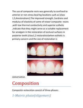 The use of composite resin was generally to confined to
anterior or non stress bearing locations such as (class
1,5,4restorations).The improved strength ,hardness and
modulus of elasticity of some of newer compsoite resins
,with low thermal conductivity and superior esthetic
,indicate that they might serve as a suitable replacement
for amalgam in the restoration of occlusal surfaces in
posterior teeth (class1,2 restoration)when esthetic is
primary concern and the size of restoration is




conservative.

Composition
Composite restoration consist of three phases:

1-Matrix phase(oligomers)
 