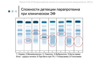 Лапин С.В.,IV Всероссийская школа по клинической иммунологии, 2013г.


    Сложности детекции парапротеина
    при клиническом ЭФ




1. Норма; 2 Минимоноклон; 3. Гемолиз; 4 Фибриноген; 5 Бета-гамма
блок - цирроз печени; 6 Пре-бета при ГН; 7 Гипергамма; 8 Гипогамма
 