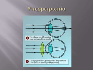 το ανθρώπινο μάτι κων να σουρτζη