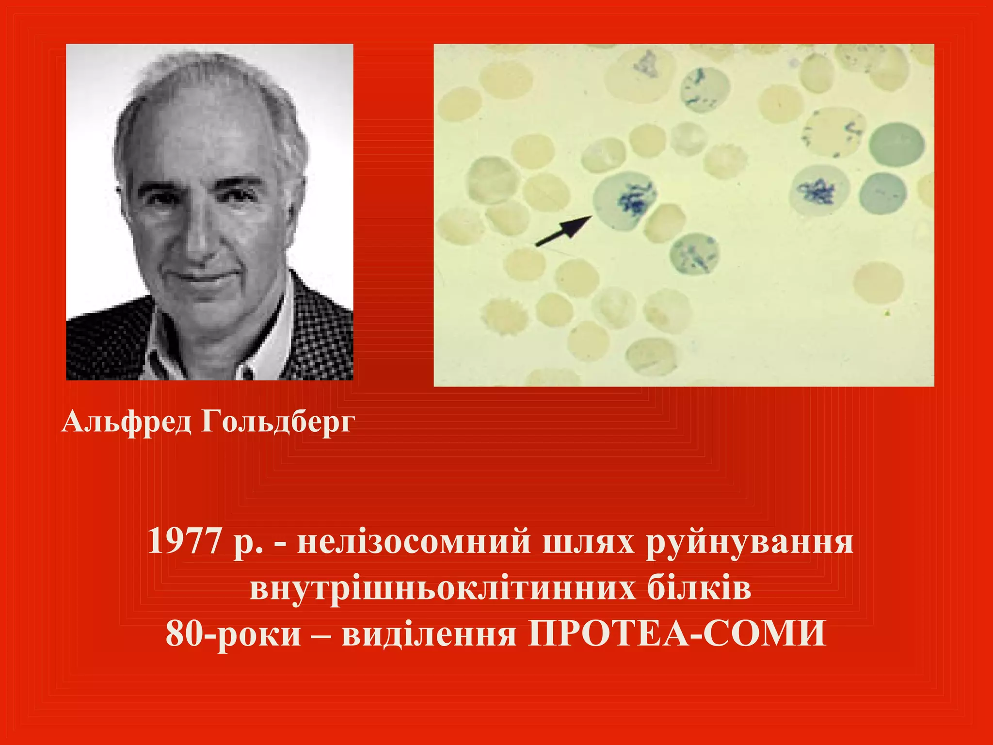 Альфред Гольдберг


    1977 р. - нелізосомний шлях руйнування
          внутрішньоклітинних білків
     80-роки – виділення ПРОТЕА-СОМИ
 