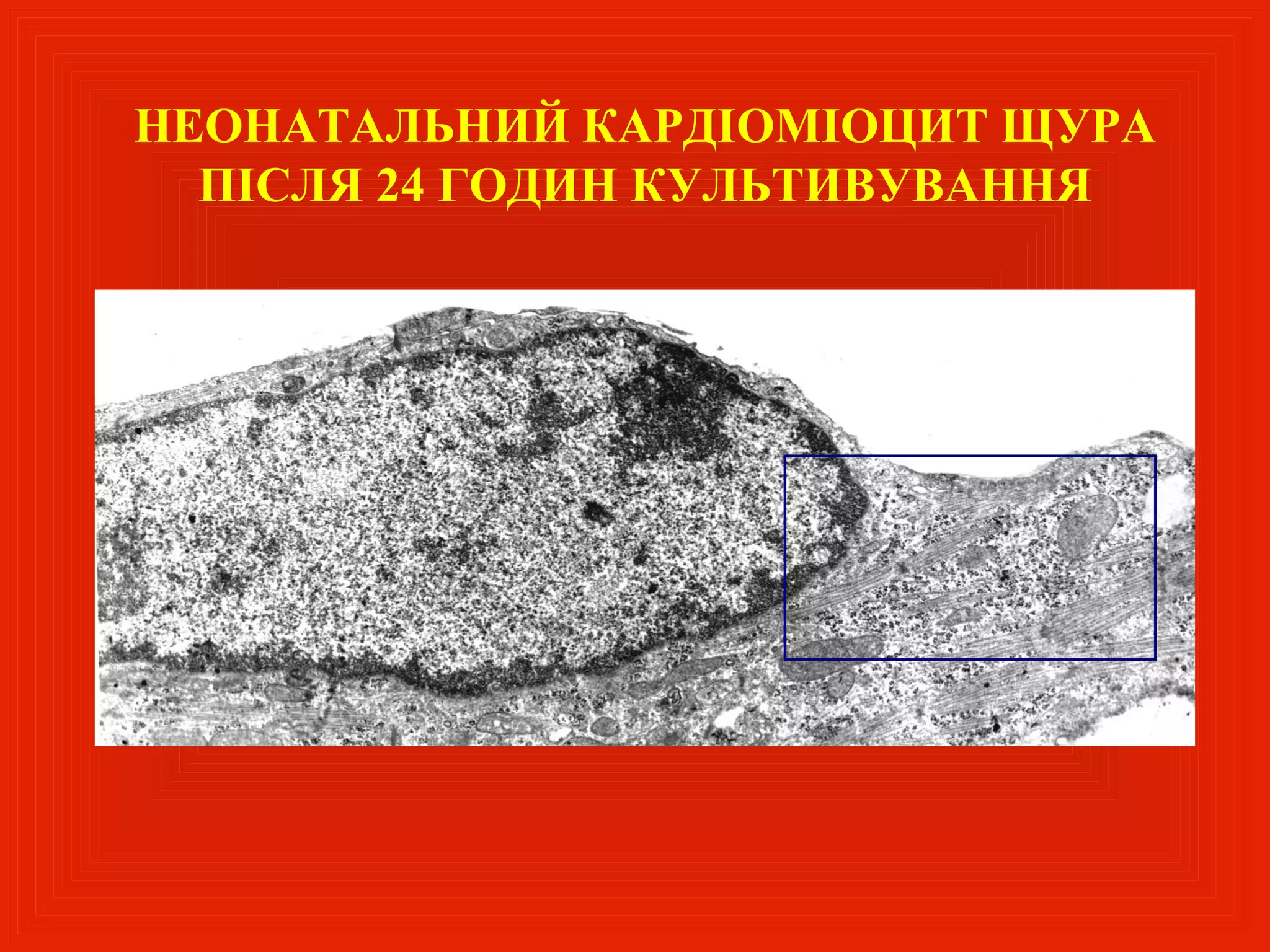 НЕОНАТАЛЬНИЙ КАРДІОМІОЦИТ ЩУРА
  ПІСЛЯ 24 ГОДИН КУЛЬТИВУВАННЯ
 