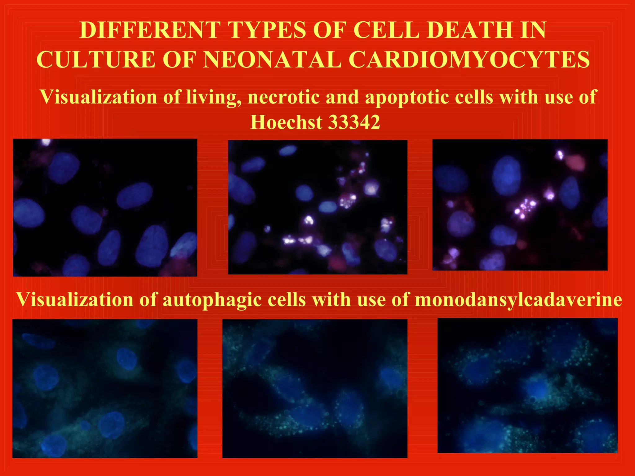 DIFFERENT TYPES OF CELL DEATH IN
  CULTURE OF NEONATAL CARDIOMYOCYTES
  Visualization of living, necrotic and apoptotic cells with use of
                           Hoechst 33342




Visualization of autophagic cells with use of monodansylcadaverine
 
