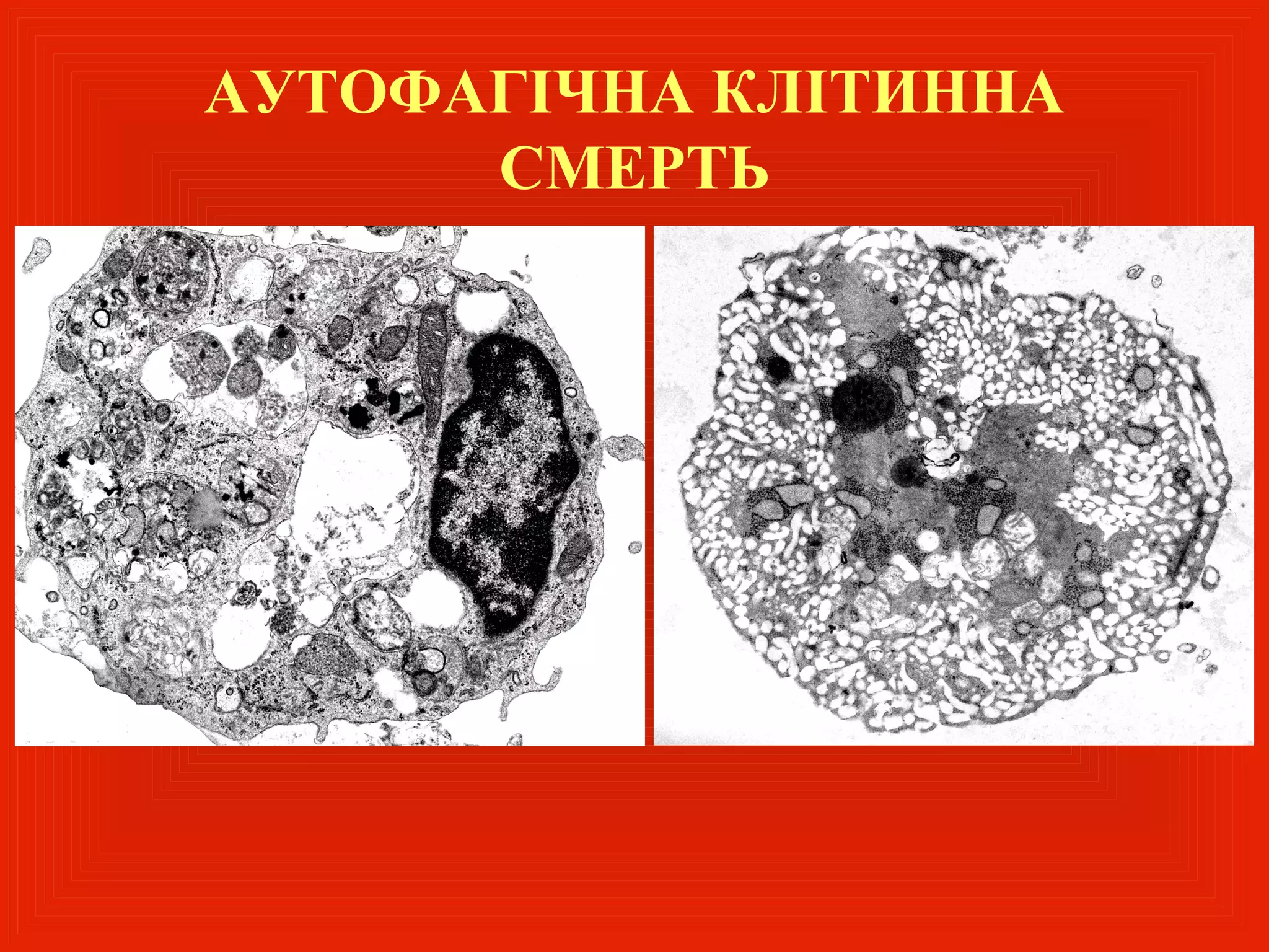 АУТОФАГІЧНА КЛІТИННА
      СМЕРТЬ
 
