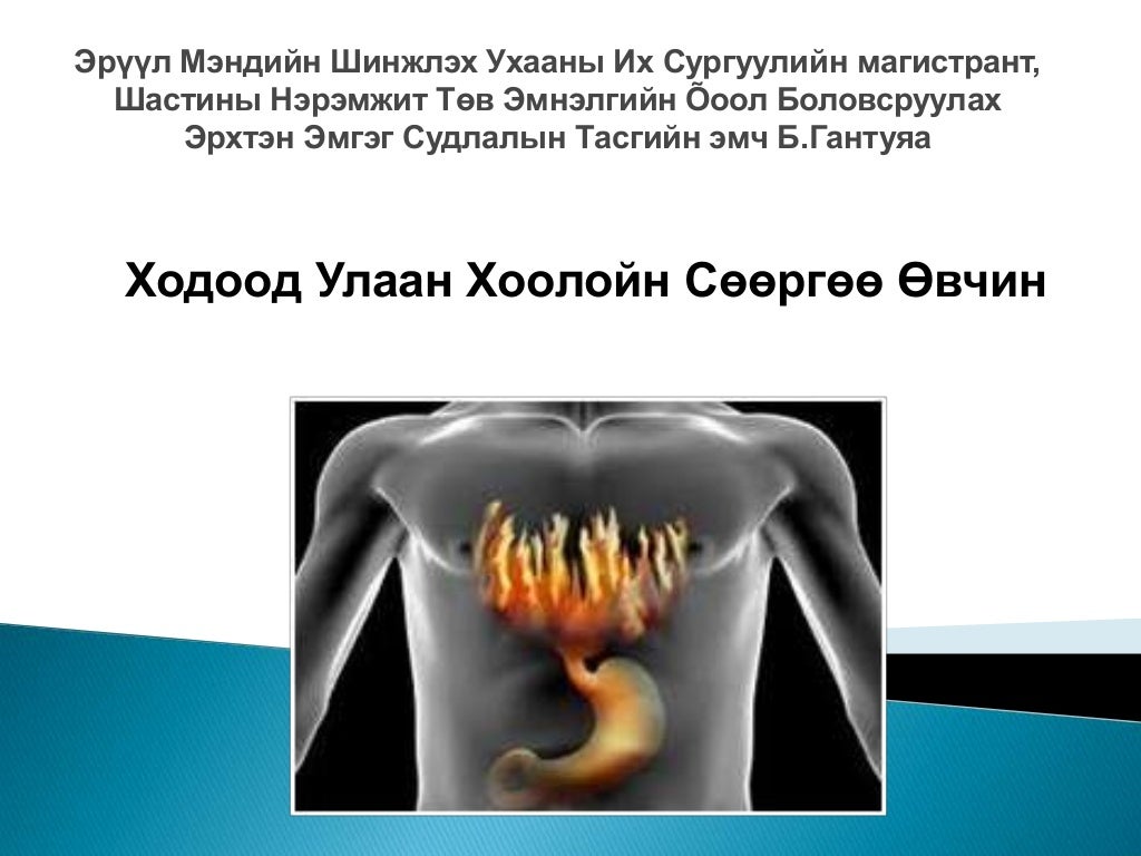 ходоод улаан хоолойн сөөргөө өвчин