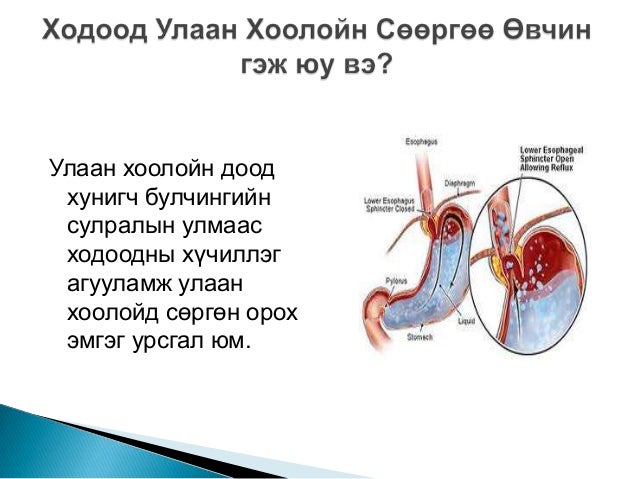ходоод улаан хоолойн сөөргөө өвчин