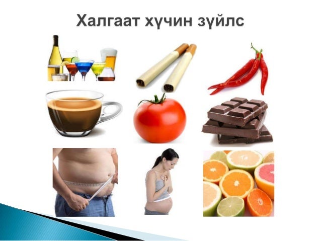 ходоод улаан хоолойн сөөргөө өвчин