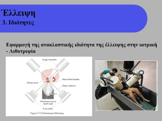 Έλλειψη
3. Ιδιότητες


 Εφαρμογή της ανακλαστικής ιδιότητα της έλλειψης στην ιατρική
 - Λιθοτριψία
 