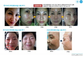 유명 종합병원 14곳 강남 380곳 성형외과에 6년간 납품
이바인 화장품 60일 사용 후기           검증완료   검증받은 제품으로 안전하고 효과가 뛰어납니다.




    Befor           20일        30일                40일        현재

이바인 화장품 20일 사용 후기                     이바인화장품 30일 사용 후기




   Befor              20일                 Befor            30일
 