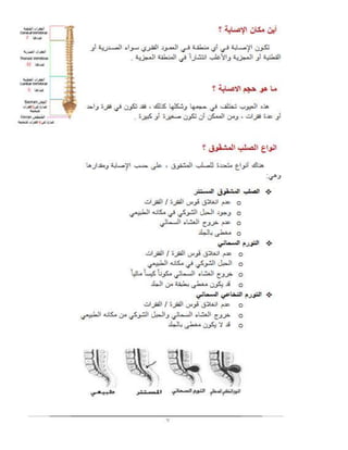 بحث الصلب المشقوق