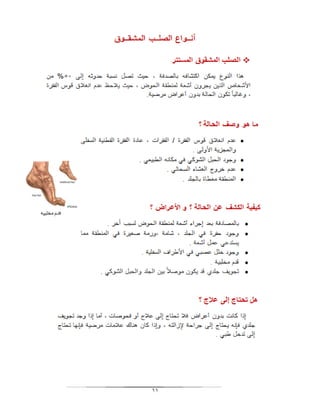 بحث الصلب المشقوق