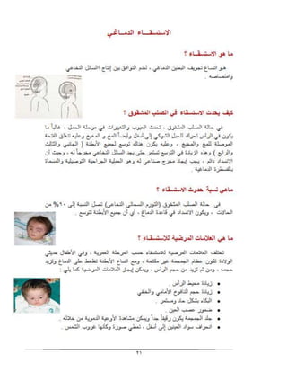 بحث الصلب المشقوق