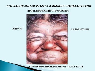 ХИРУРГ
СОГЛАСОВАННАЯ РАБОТА В ВЫБОРЕ ИМПЛАНТАТОВ
ПРОТЕЗИРУЮЩИЙ СТОМАТОЛОГ
ЛАБОРАТОРИЯ
КОМПАНИЯ, ПРОИЗВОДЯШАЯ ИПЛАНТАТЫ
 
