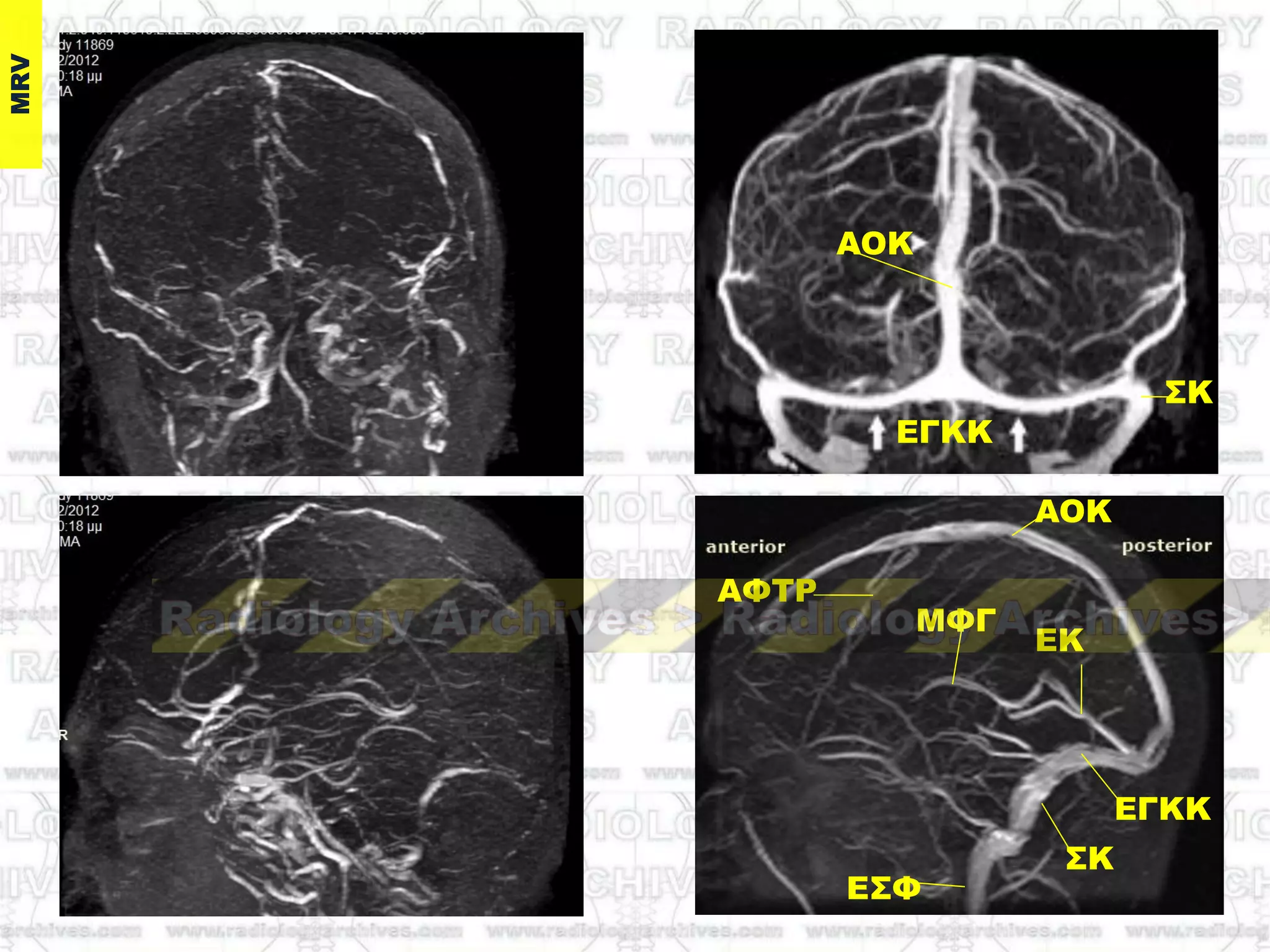 AOK
EΓΚK
΢K
ΕΚ
ΜΥΓ
Ε΢Υ
ΑΥΣΡ
AOK
EΓΚK
΢K
 