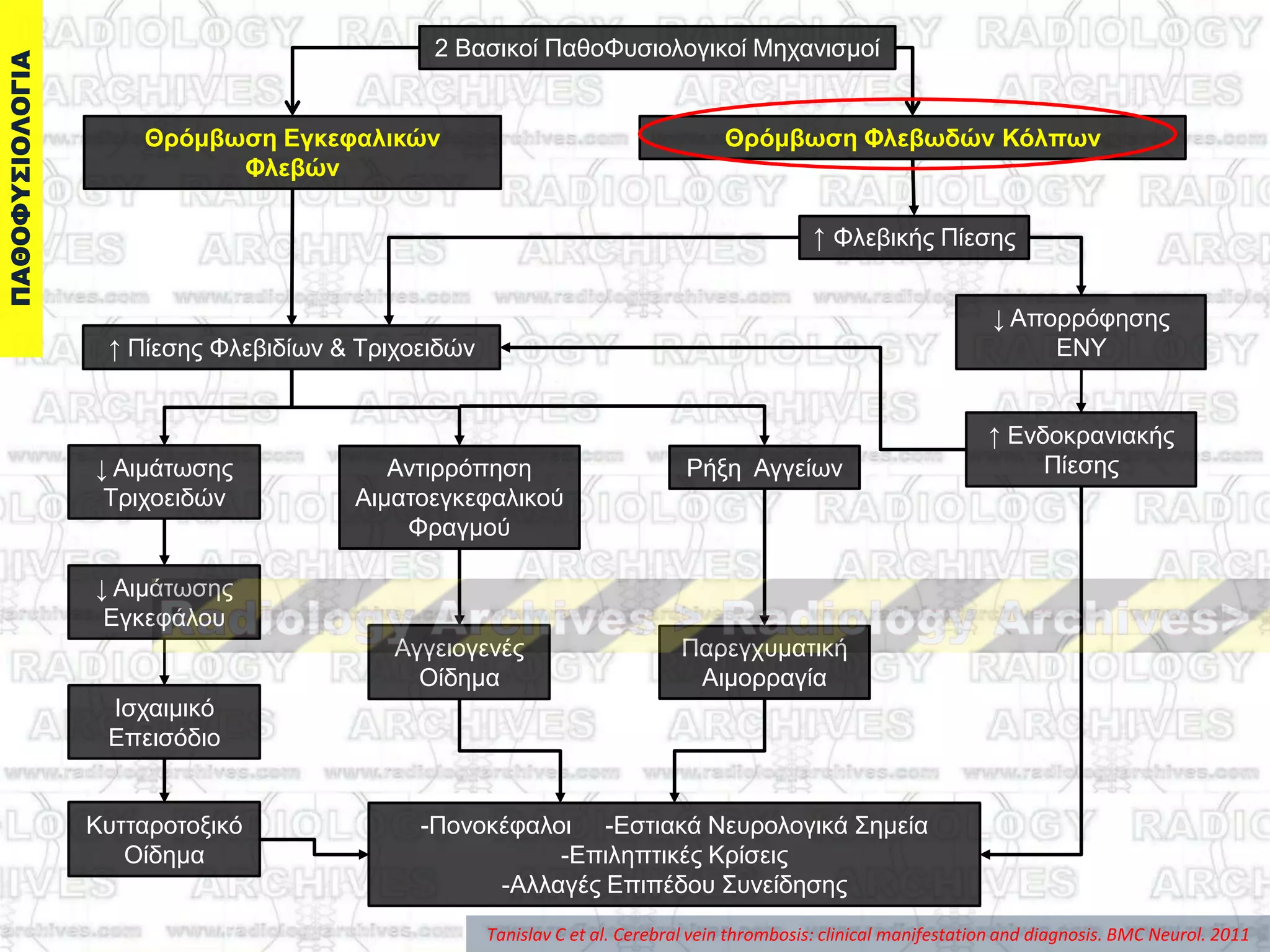 2 Βαζηθνί ΠαζνΦπζηνινγηθνί Μεραληζκνί
Θπόμβωζη Δγκεθαλικών
Φλεβών
Θπόμβωζη Φλεβωδών Κόλπων
↑ Φιεβηθήο Πίεζεο
↓ Απνξξόθεζεο
ΔΝΤ
↑ Δλδνθξαληαθήο
Πίεζεο
↑ Πίεζεο Φιεβηδίσλ & Σξηρνεηδώλ
↓ Αηκάησζεο
Σξηρνεηδώλ
↓ Αηκάησζεο
Δγθεθάινπ
Ηζραηκηθό
Δπεηζόδην
Κπηηαξνηνμηθό
Οίδεκα
Αληηξξόπεζε
Αηκαηνεγθεθαιηθνύ
Φξαγκνύ
Αγγεηνγελέο
Οίδεκα
Ρήμε Αγγείσλ
Παξεγρπκαηηθή
Αηκνξξαγία
-Πνλνθέθαινη -Δζηηαθά Νεπξνινγηθά ΢εκεία
-Δπηιεπηηθέο Κξίζεηο
-Αιιαγέο Δπηπέδνπ ΢πλείδεζεο
Tanislav C et al. Cerebral vein thrombosis: clinical manifestation and diagnosis. BMC Neurol. 2011
 