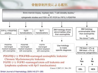 骨髄 刺所見による鑑別.Review
British Journal of Haematology, 2009;145:271–285
PDGFRβ (+): PDGFRB-rearranged eosinophilic leukemia/
Chronoic Myelomonocytic leukemia
FGFR1 (+): FGFR1-rearranged (stem cell leukemia and
lymphoma syndrome with 8p11 translocations)
Cancer J 2007;13: 384–391
 