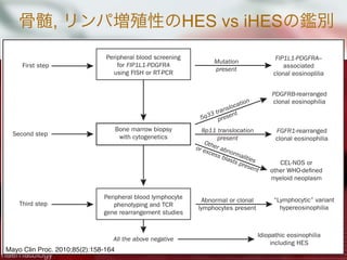 骨髄, リンパ増殖性のHES vs iHESの鑑別OSINOPHILIC SYNDROME AND CLONAL EOSINOPHILIA
Peripheral blood screening
for FIP1L1-PDGFRA
using FISH or RT-PCR
Bone marrow biopsy
with cytogenetics
Peripheral blood lymphocyte
phenotyping and TCR
gene rearrangement studies
First step
Second step
Third step
Mutation
present
Idiopathic eosinophilia
including HES
“Lymphocytic” variant
hypereosinophilia
5q33 translocation
present
8p11 translocation
present
Other abnormalities
or excess blasts present
All the above negative
FIP1L1-PDGFRA–
associated
clonal eosinoplilia
PDGFRB-rearranged
clonal eosinophilia
FGFR1-rearranged
clonal eosinophilia
CEL-NOS or
other WHO-defined
myeloid neoplasm
Abnormal or clonal
lymphocytes present
Mayo Clin Proc. 2010;85(2):158-164
 
