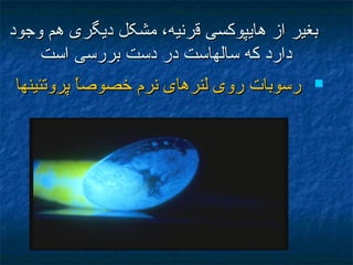 ‫بغير‬‫بغير‬‫وجود‬ ‫هم‬ ‫ديگری‬ ‫مشکل‬ ،‫قرنيه‬ ‫هايپوکسی‬ ‫از‬‫وجود‬ ‫هم‬ ‫ديگری‬ ‫مشکل‬ ،‫قرنيه‬ ‫هايپوکسی‬ ‫از‬
‫است‬ ‫بررسی‬ ‫دست‬ ‫در‬ ‫سالهاست‬ ‫که‬ ‫دارد‬‫است‬ ‫بررسی‬ ‫دست‬ ‫در‬ ‫سالهاست‬ ‫که‬ ‫دارد‬
‫پروتئينها‬ ‫ا‬ً ‫خصوص‬ ‫نرم‬ ‫لنرهای‬ ‫روی‬ ‫رسوبات‬‫پروتئينها‬ ‫ا‬ً ‫خصوص‬ ‫نرم‬ ‫لنرهای‬ ‫روی‬ ‫رسوبات‬
 