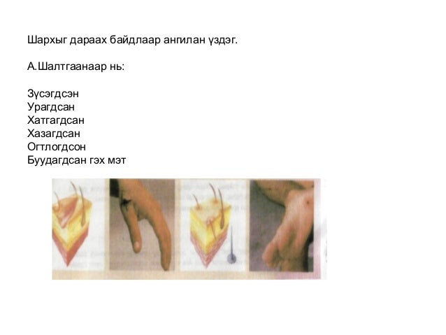 цус алдалтын үед
