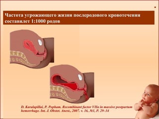 D. Karalapillai, P. Popham. Recombinant factor VIIa in massive postpartum
hemorrhage. Int. J. Obstet. Anest., 2007. v. 16, №1, P. 29–34
Частота угрожающего жизни послеродового кровотечения
составялет 1:1000 родов
 