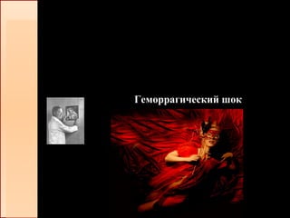 Геморрагический шок
 