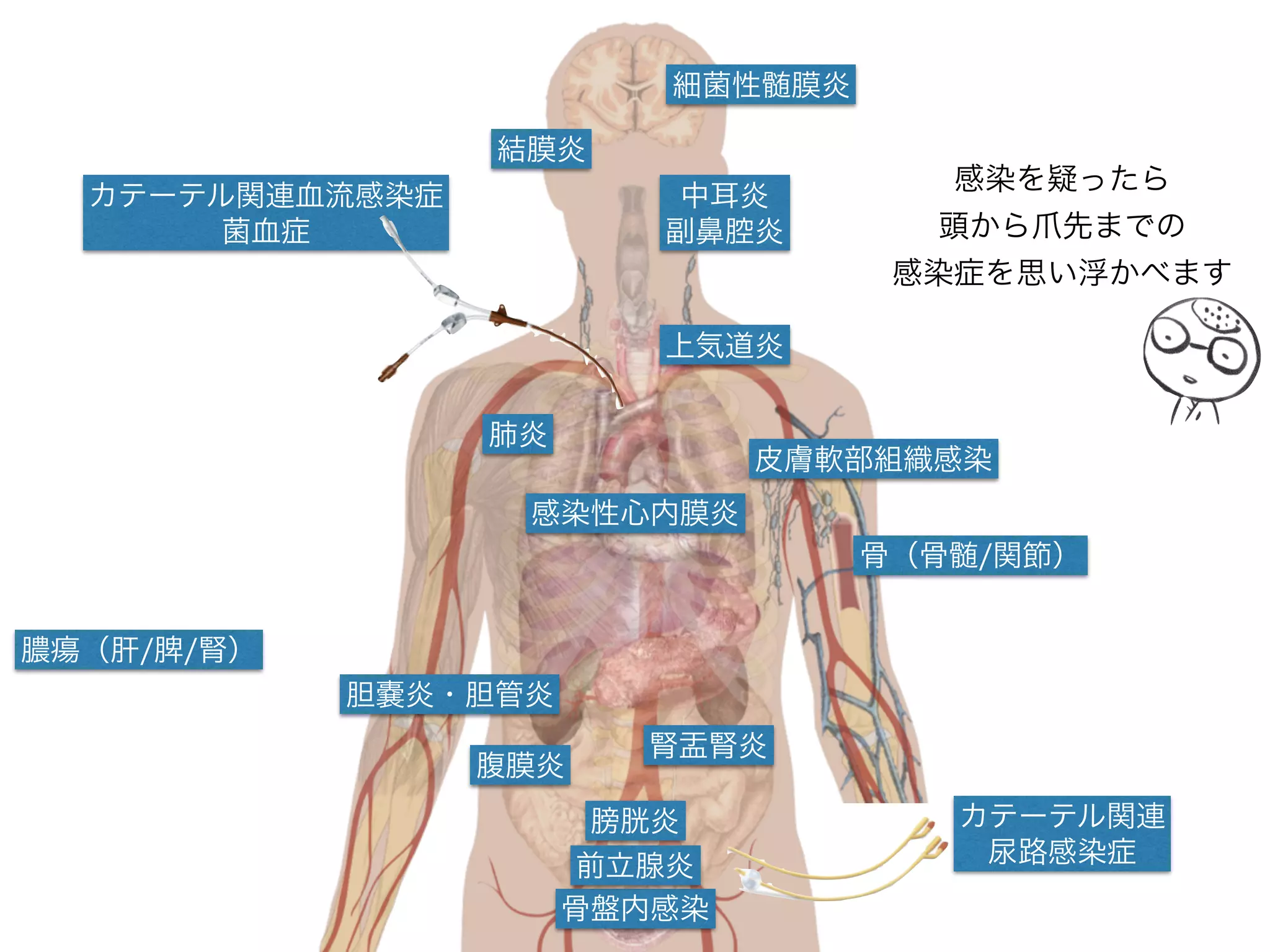 ここでもう一度
Pseudomonas aeruginosa
「緑膿菌はどうして耐性を獲得しやすいの？」
緑膿菌はもともと薬剤耐性の菌で、抗菌薬を使用することで
さらに耐性遺伝子が発現する
「緑膿菌には以下の耐性が元来備わっています。
　①外膜の透過性の低下、②排出ポンプの発現、
　③分解酵素の発現、④薬剤作用点の変化」
 