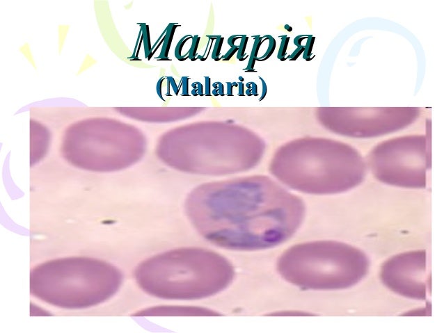 малярія