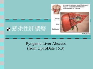 感染性肝膿瘍
Pyogenic Liver Abscess
(from UpToDate 15.3)
 