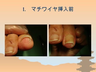 1. ޥ磻䒷ǰ
 