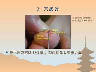 2. Ѩ
? äѨ 18G ᘣ 23G ᘤʤɤä
quoted from Dr.
Machida's website
 