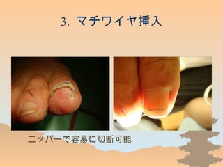 3. ޥ磻䒷
˥åѩ`פжϿ
 