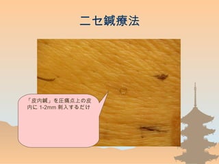 ˥P
ƤPRʹϤƤ
ڤ 1-2mm 뤹
 