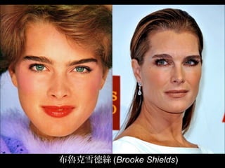 布魯克雪德絲 (Brooke Shields)
 