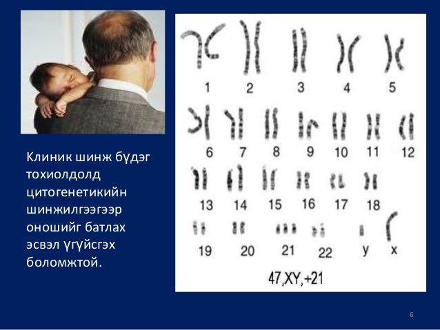пренатал оношилгоо