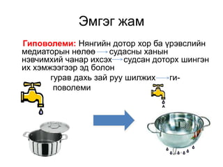 үжилийн яаралтай тусламж | PPT
