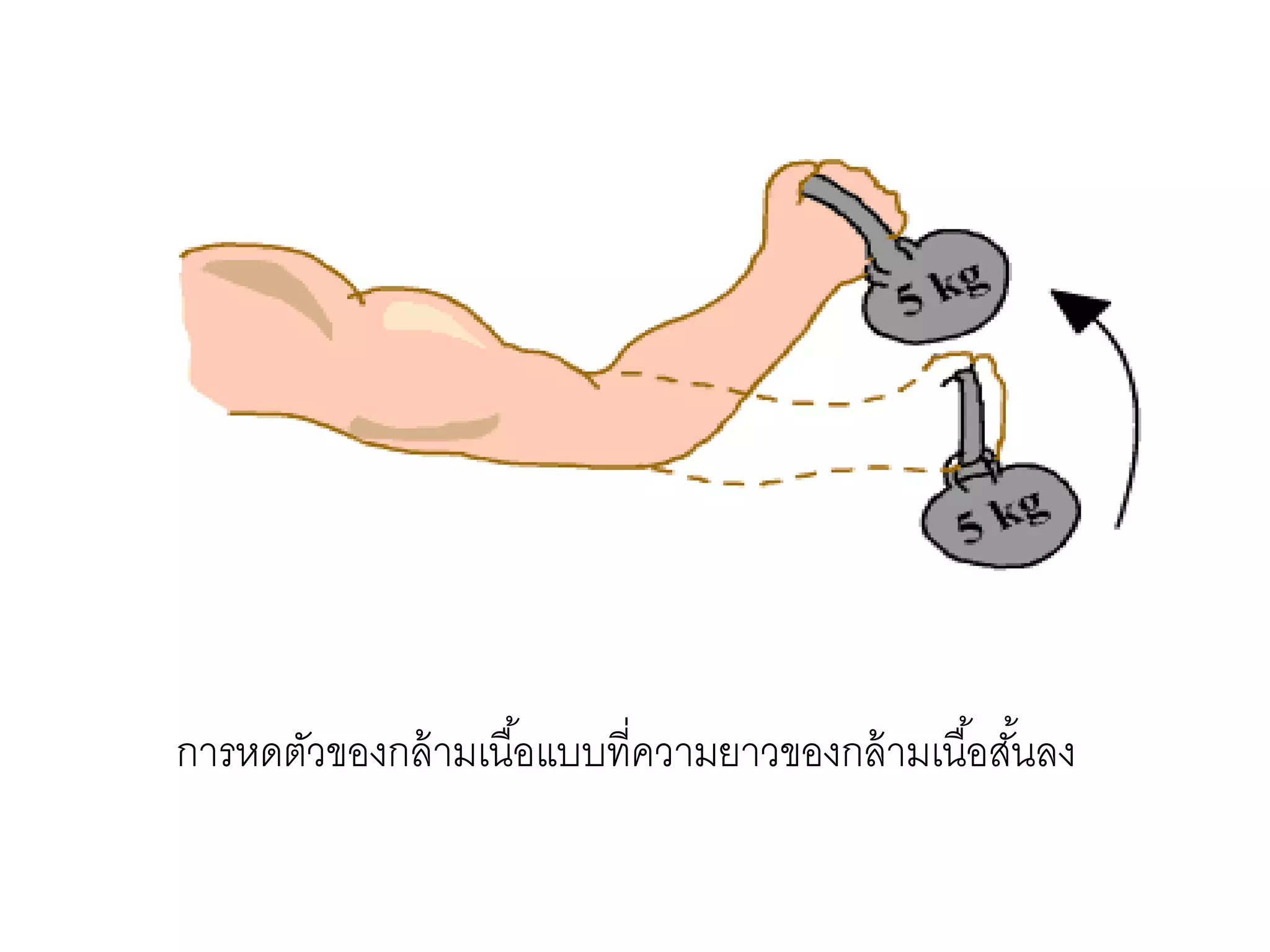 การหดตัวของกล้ามเนื้อแบบที่ความยาวของกล้ามเนื้อสั้นลง
 