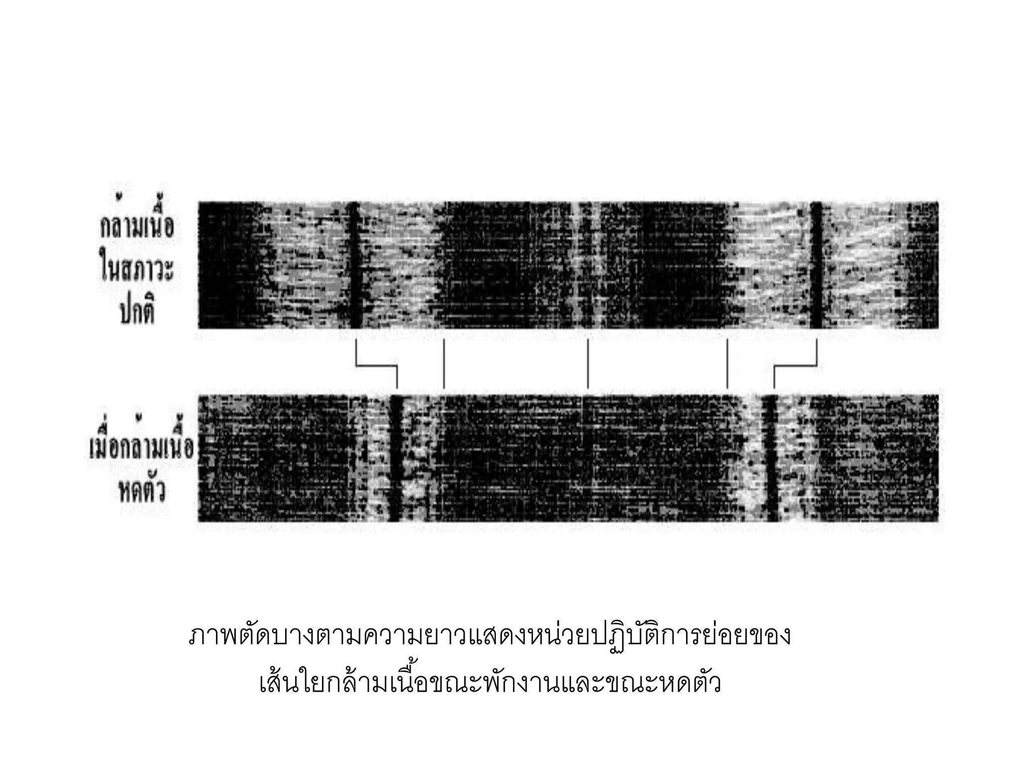 ภาพตัดบางตามความยาวแสดงหน่วยปฏิบัติการย่อยของ
เส้นใยกล้ามเนื้อขณะพักงานและขณะหดตัว
 