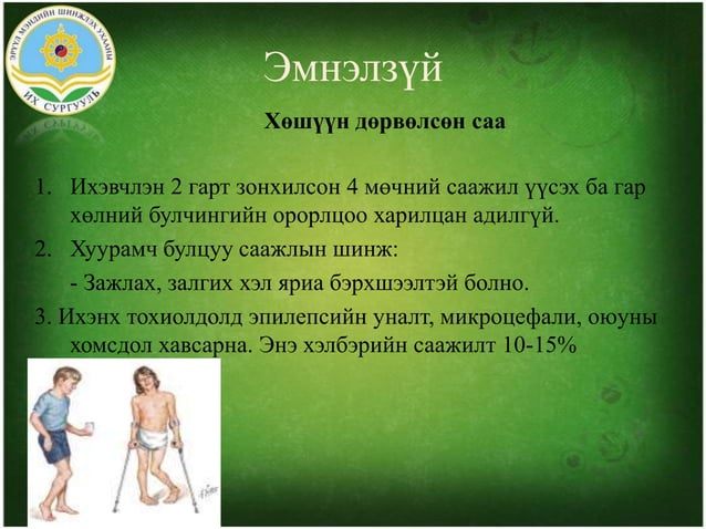 Хүүхдийн тархины саа