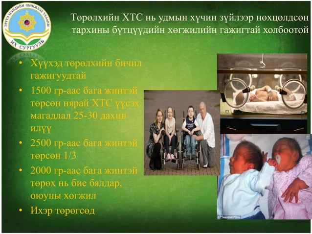 Хүүхдийн тархины саа