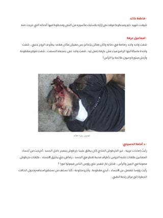 ‫ فاطمة خالد:‬‫شوفت شهيد نايم ومحطوط فوقه نص إزازه بالستيك مكسوره من النص ومحطوط فيها أمعائه اللي خرجت منه‬
‫ اسماعيل عرفة...