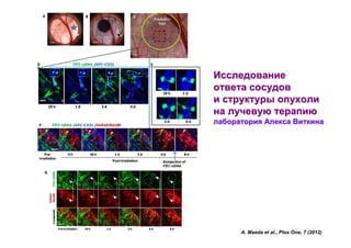 Исследование
ответа сосудов
и структуры опухоли
на лучевую терапию
лаборатория Алекса Виткина

A. Maeda et al., Plos One, 7 (2012)

 