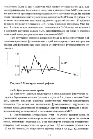 тельностью более 10 сек. Амплитуда МКР зависит от способности ЦНС пло­
да координировать функции его скелетных мышц и сердца. МКР существен­
но изменяется при нарушении функционального состояния плода. На первом
этапе гипоксия приводит к увеличению амплитуды МКР более 35 уд/мин, что
является проявлением адаптации сердечно-сосудистой системы. Углубление
гипоксии приводит к угнетению ЦНС плода, снижению амплитуды МКР ме­
нее 15 уд/мин вплоть до его полного исчезновения. За 30 минут исследования
в активном состоянии должно быть зарегистрировано не менее б эпизодов
шевелений плода, сопровождаемых адекватным МКР.
При отсутствии эпизодов шевелений плода во время регистрации КТГ
показано проведение функциональных проб, оценка результатов которых по­
зволяет дифференцировать фазу покоя от нарушения функционального со­
стояния.
1JU

140

мкр

/ И

^ ^

130

ч с с

Рисунок 2. Миокардиальный рефлекс
1.4.2. Функциональные пробы
А) Степ-тест, который заключается в использовании физической на­
грузки у беременных женщин (подъем и спуск на 2 ступени в течение 3 ми­
нут), которая вызывает снижение интенсивности маточно-плацентарного
кровотока. При отсутствии выраженного функционального нарушения со­
стояния плода дозированная физическая нагрузка матери приводит к увели­
чению амплитуды осцилляции и появлению адекватного МКР.
Б) Окситоциновый (стрессовый) тест - из учение реакции плода на
уменьшение кровотока в межворсинчатом пространстве во время сокращения
матки, вызванного окситоцином. Тест моделирует стрессовое воздействие,
которому плод подвергается во время родов. 1ЕД окситоцина разводится в
100 мл 5% глюкозы. Из полученного раствора берут 1 мл (0,01 ЕД окситоци15

 