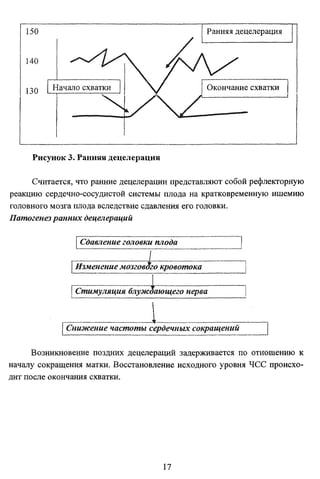 Ранняя децелерация

150
140
130

Начало схватки

Окончание схватки

Рисунок 3. Ранняя децелерация
Считается, что ранние децелерации представляют собой рефлекторную
реакцию сердечно-сосудистой системы плода на кратковременную ишемию
головного мозга плода вследствие сдавления его головки.
Патогенез ранних децелерации
Сдавление головки плода
Изменение

—4мозгового

кровотока

Стимуляция блуждающего нерва

Снижение частоты сердечных сокращений
Возникновение поздних децелерации задерживается по отношению к
началу сокращения матки. Восстановление исходного уровня ЯСС происхо­
дит после окончания схватки.

17

 