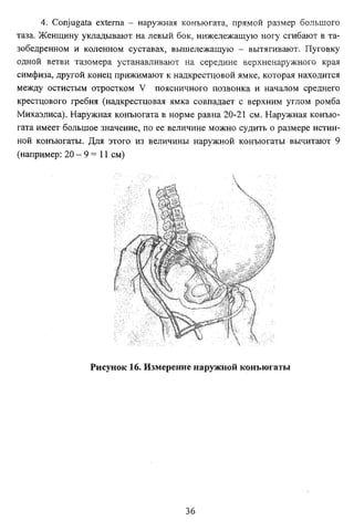 4. Conjugate externa - наружная конъюгата, прямой размер большого
таза. Женщину укладывают на левый бок, нижележащую ногу сгибают в та­
зобедренном и коленном суставах, вышележащую - вытягивают. Пуговку
одной ветви тазомера устанавливают на середине верхненаружного края
симфиза, другой конец прижимают к надкрестцовой ямке, которая находится
между остистым отростком V поясничного позвонка и началом среднего
крестцового гребня (надкрестцовая ямка совпадает с верхним углом ромба
Михаэлиса). Наружная конъюгата в норме равна 20-21 см. Наружная конъю­
гата имеет большое значение, по ее величине можно судить о размере истин­
ной конъюгаты. Для этого из величины наружной конъюгаты вычитают 9
(например: 20 - 9 = 11 см)

Рисунок 16. Измерение наружной конъюгаты

36

 
