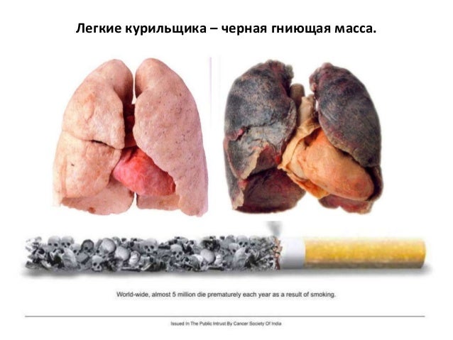 Вред Курения Презентация - airingdirectory
