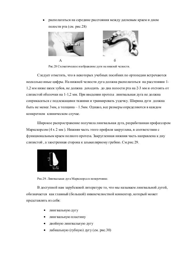 Методичка по подшипникам