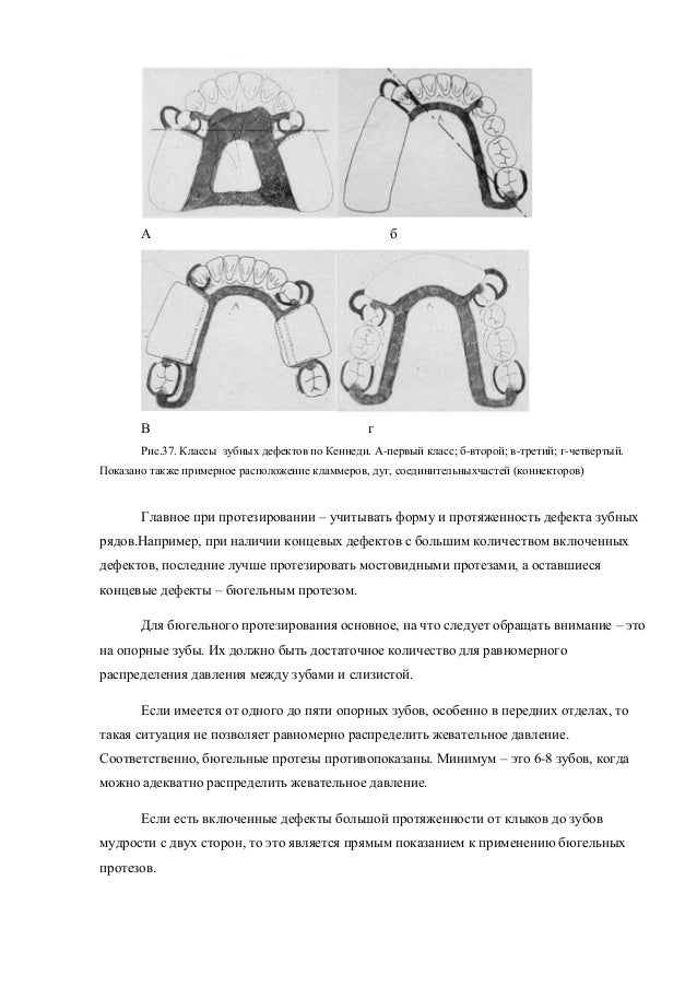 Методичка по подшипникам
