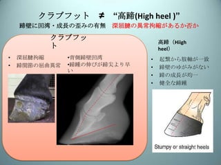装蹄療法 クラブフット ロングトーアンダーランヒール 挙踵 裂蹄