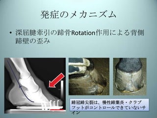 装蹄療法 クラブフット ロングトーアンダーランヒール 挙踵 裂蹄